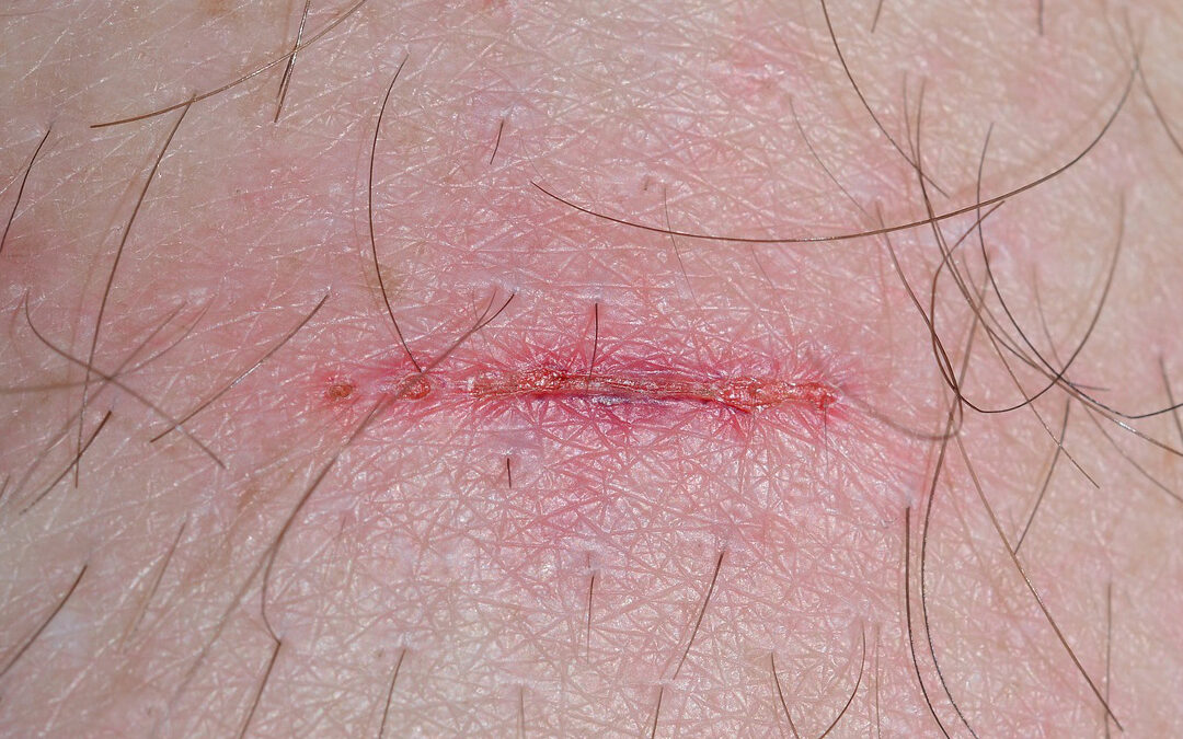 Berries Health Adult Metabolic Syndrome Plus Wound Care & Healing Disorders Panel